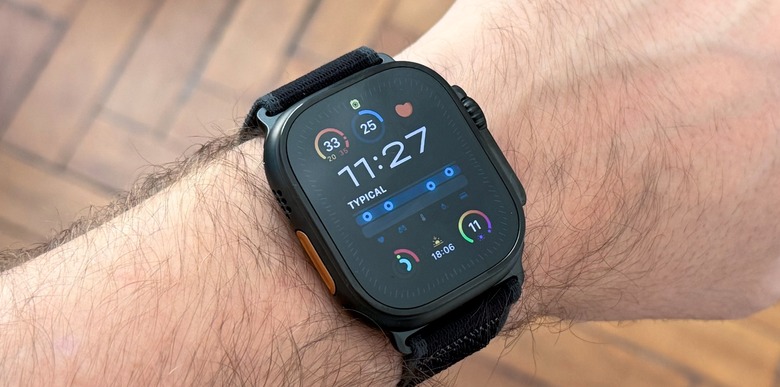 Apple Watch Series 11: más brillo en pantalla y grandes mejoras